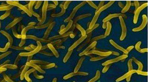 微生物菌劑好？好在哪里您知道嗎？